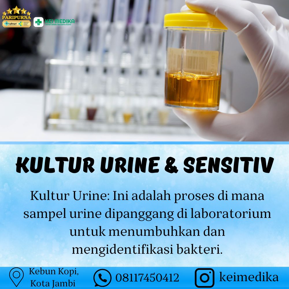 KULTUR URINE & SENSITIV