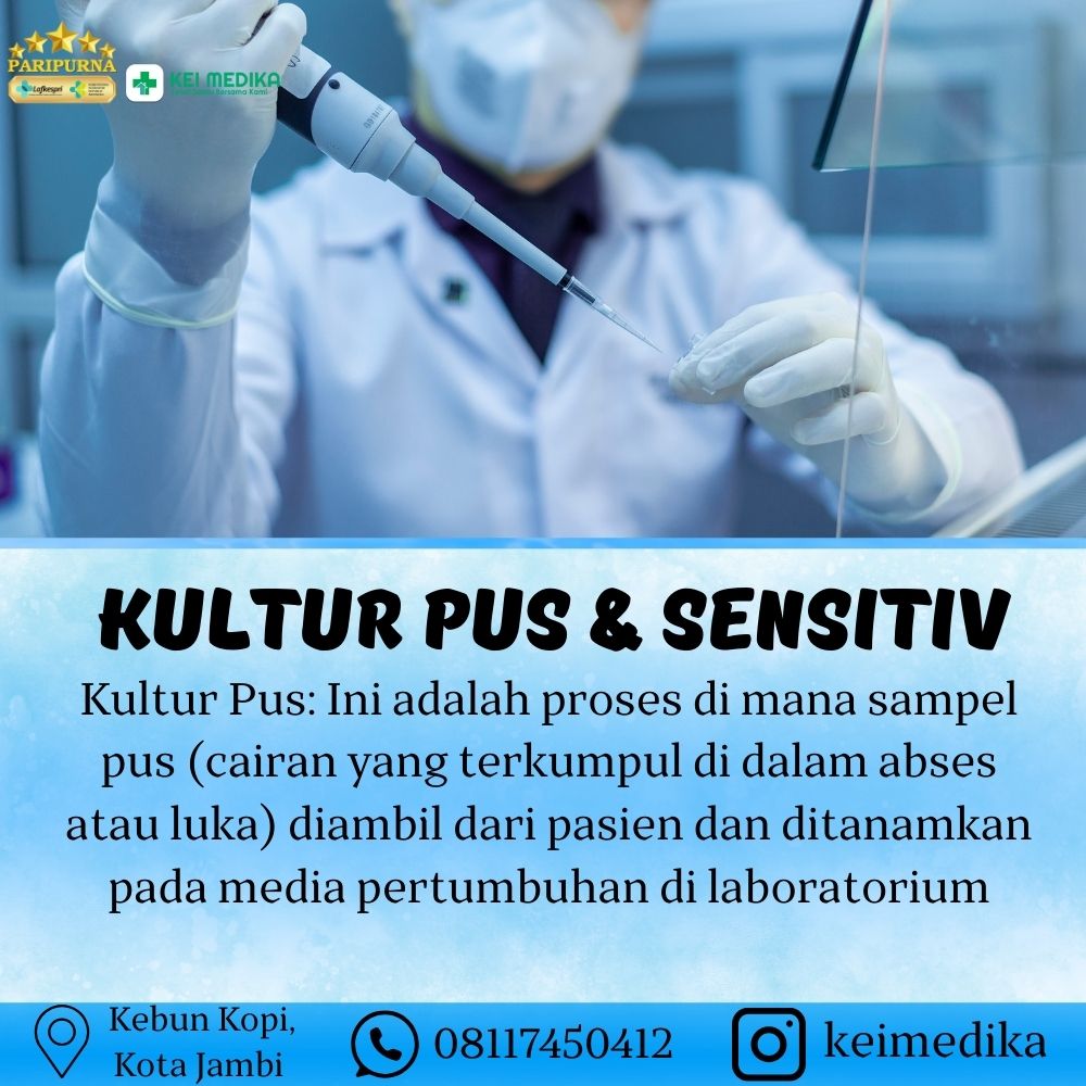 KULTUR PUS & SENSITIV