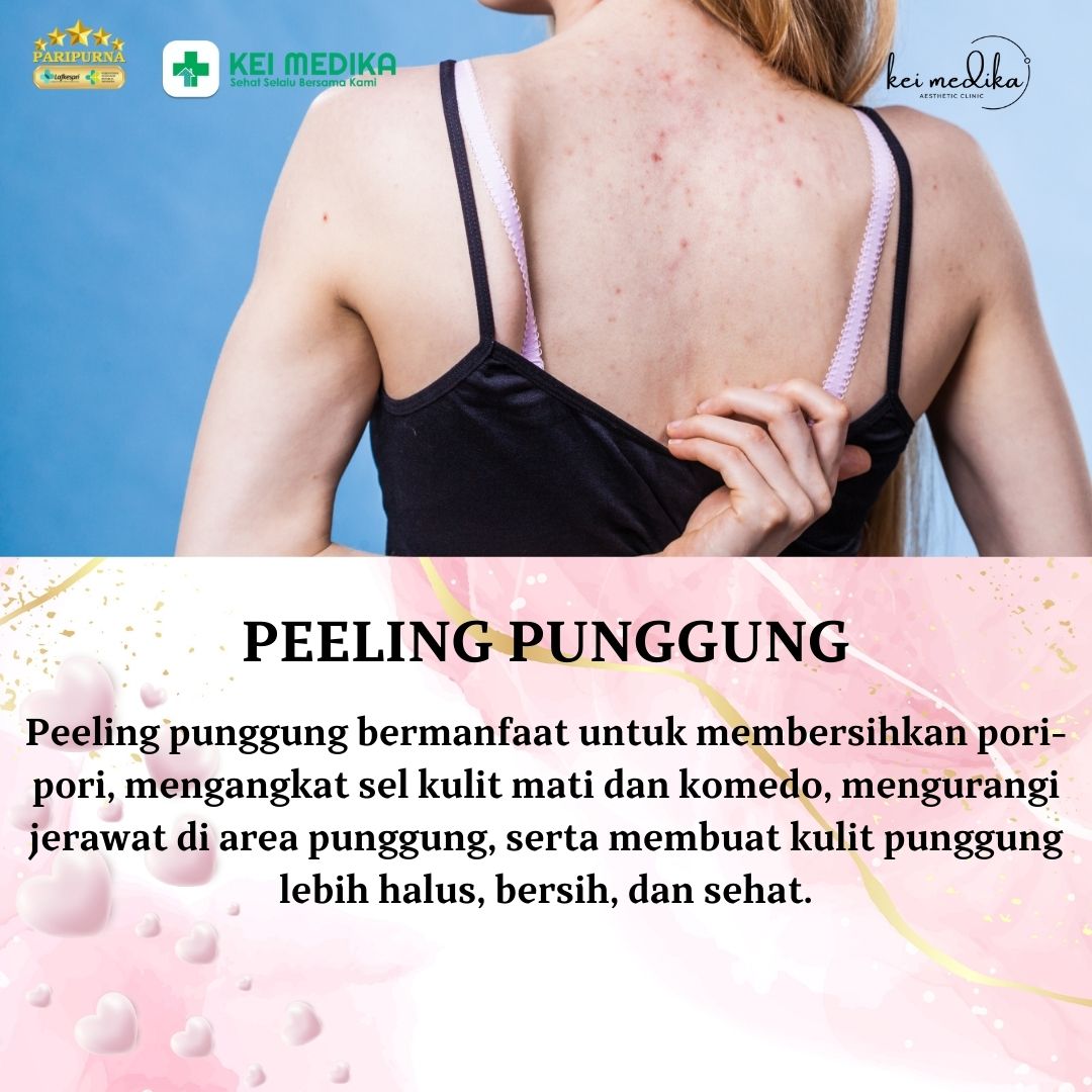 PEELING PUNGGUNG