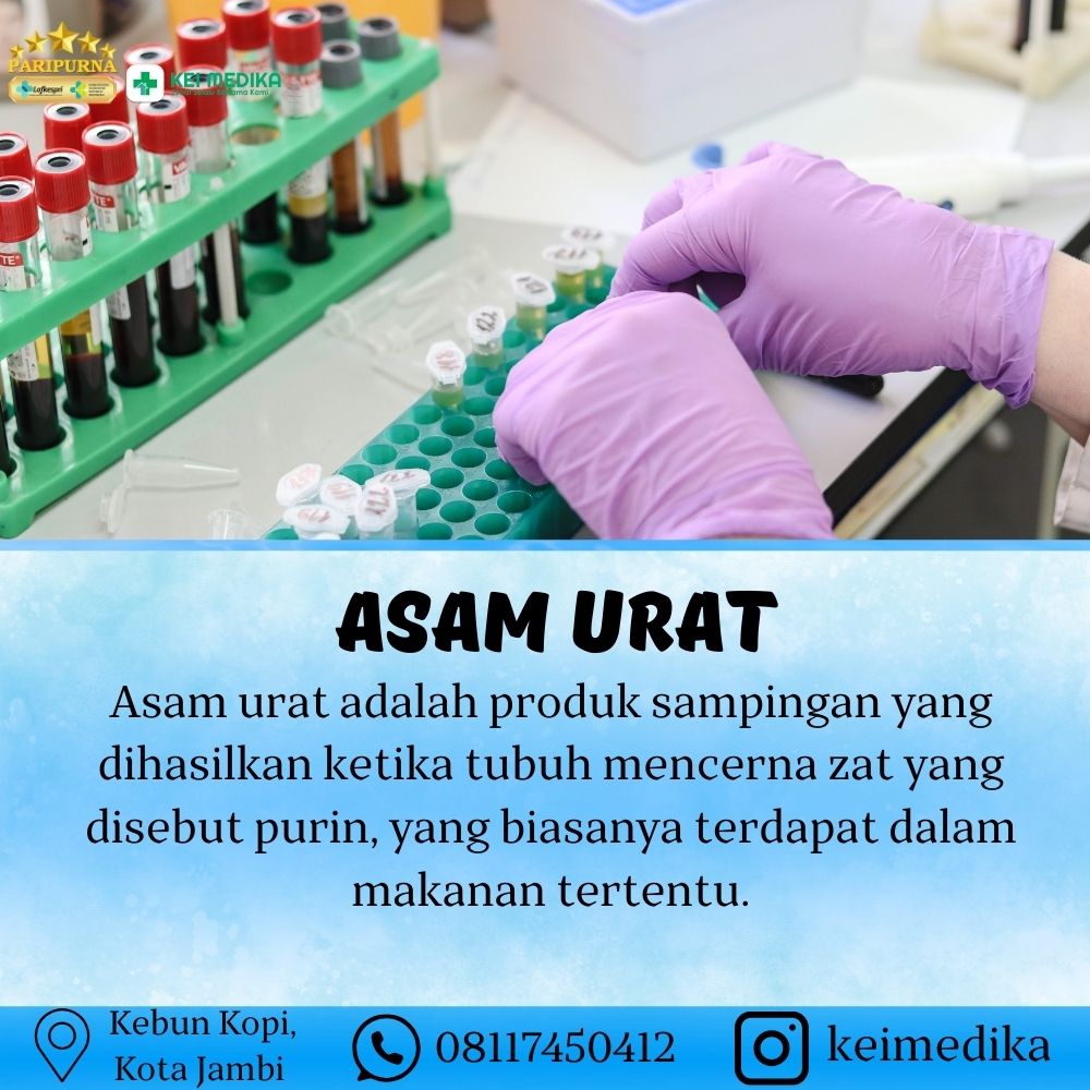 ASAM URAT