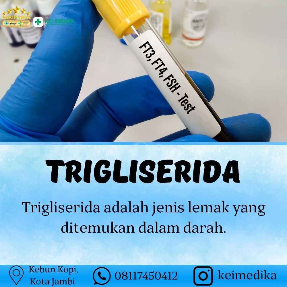TRIGLISERIDA