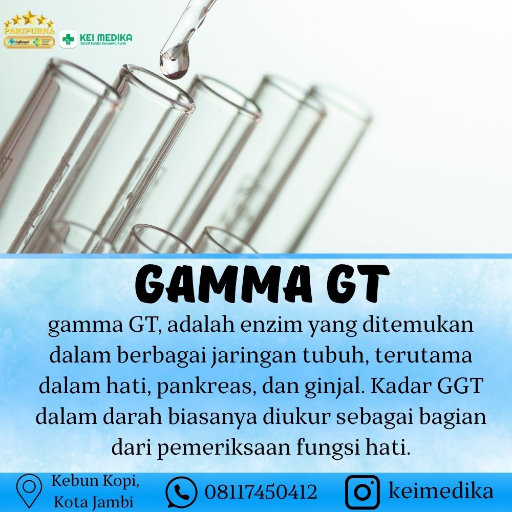 GAMMA GT