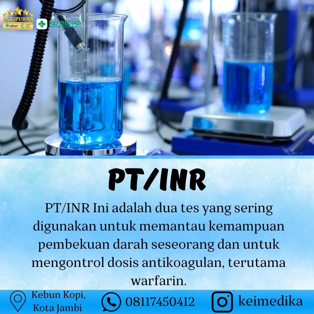 PT/INR