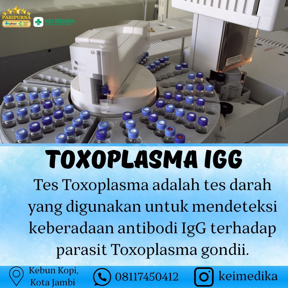 TOXOPLASMA IGG