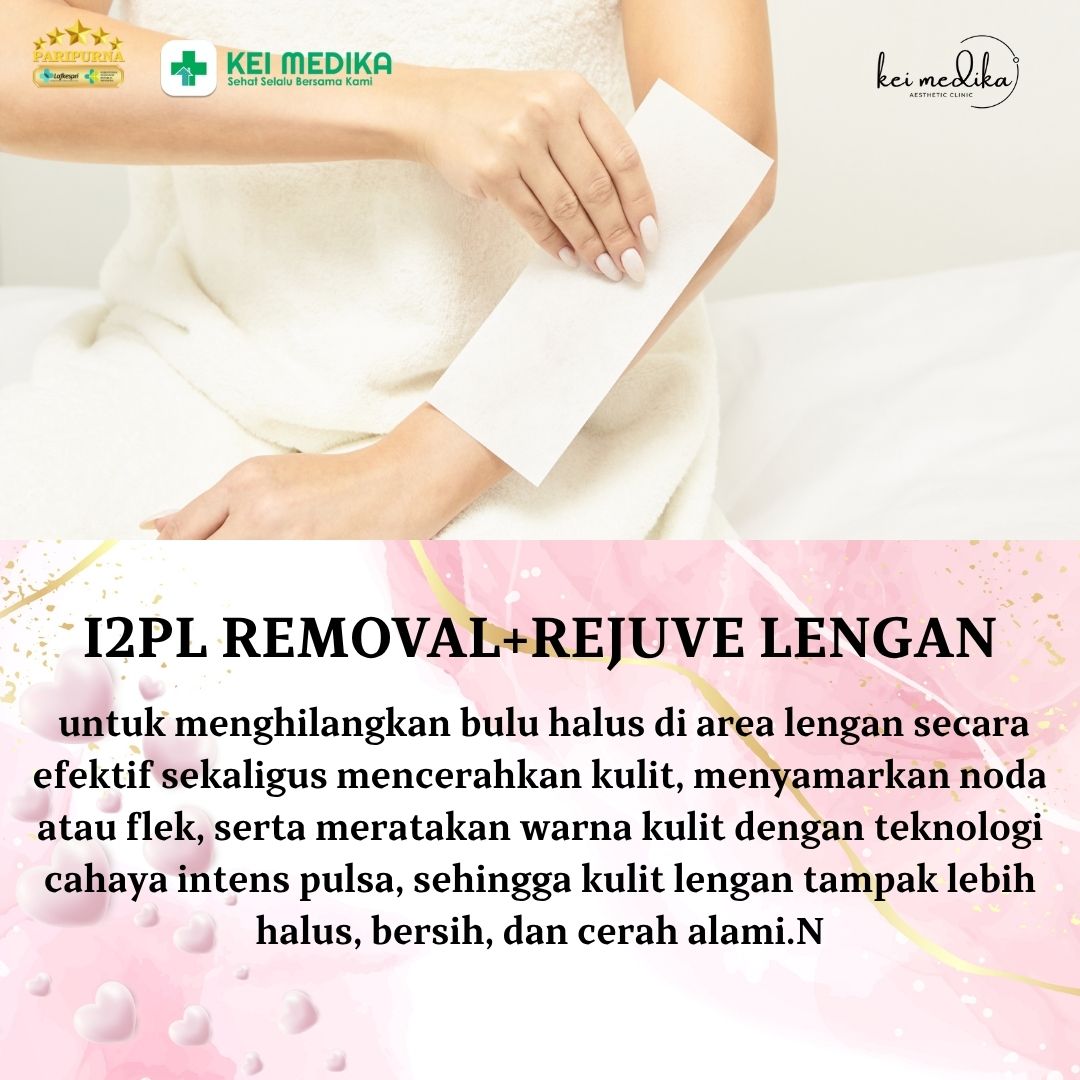 I2PL REMOVAL+REJUVE LENGAN