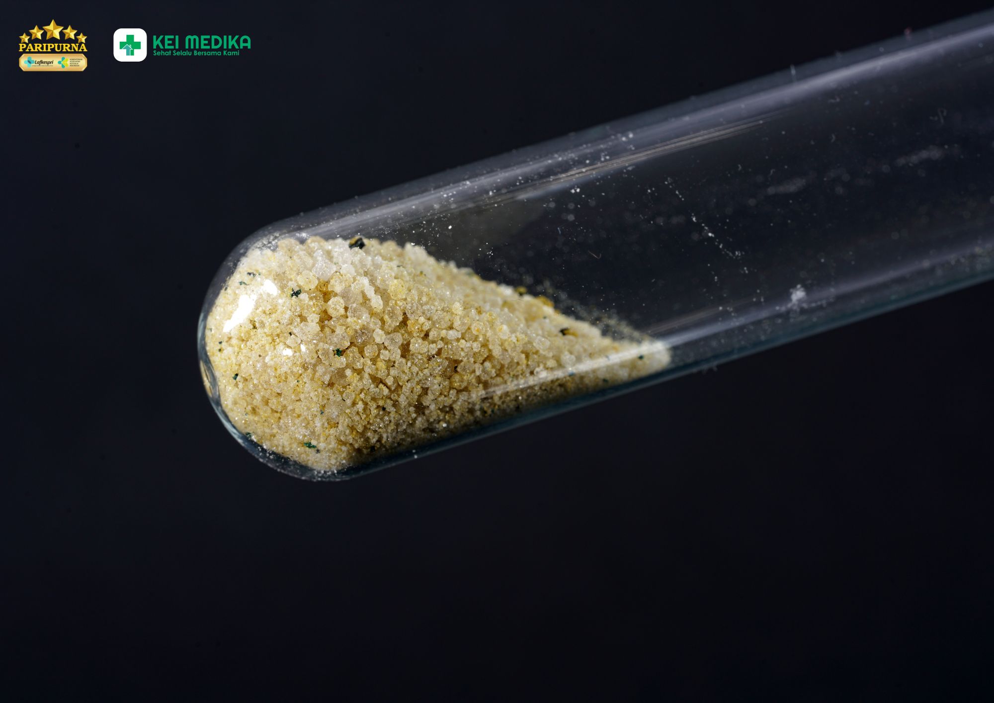 Ferrous Sulfate untuk Apa? Kenali Suplemen Zat Besi yang Sering Diresepkan