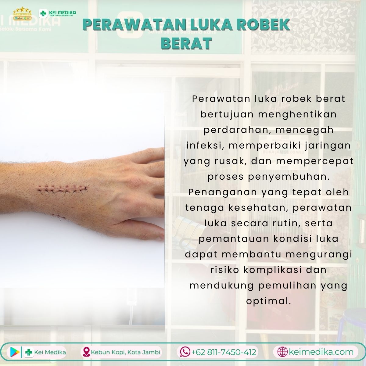 PERAWATAN LUKA ROBEK BERAT