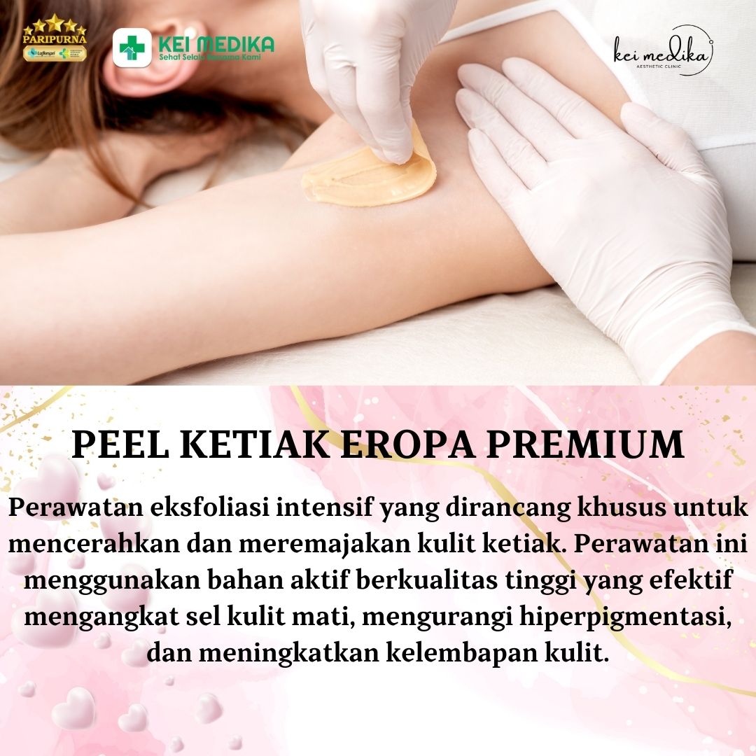 PEEL KETIAK EROPA PREMIUM