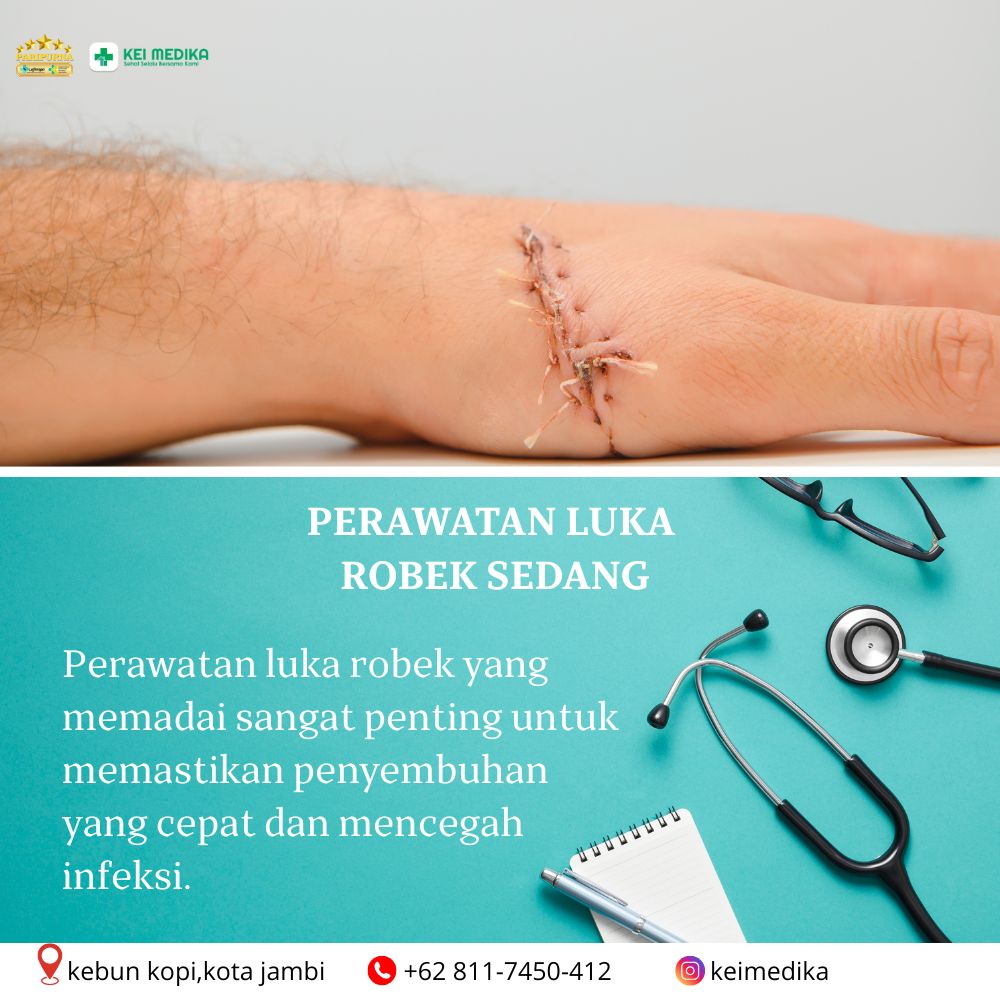 PERAWATAN LUKA ROBEK SEDANG 