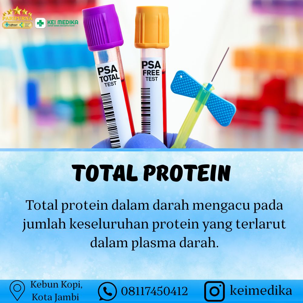 TOTAL PROTEIN