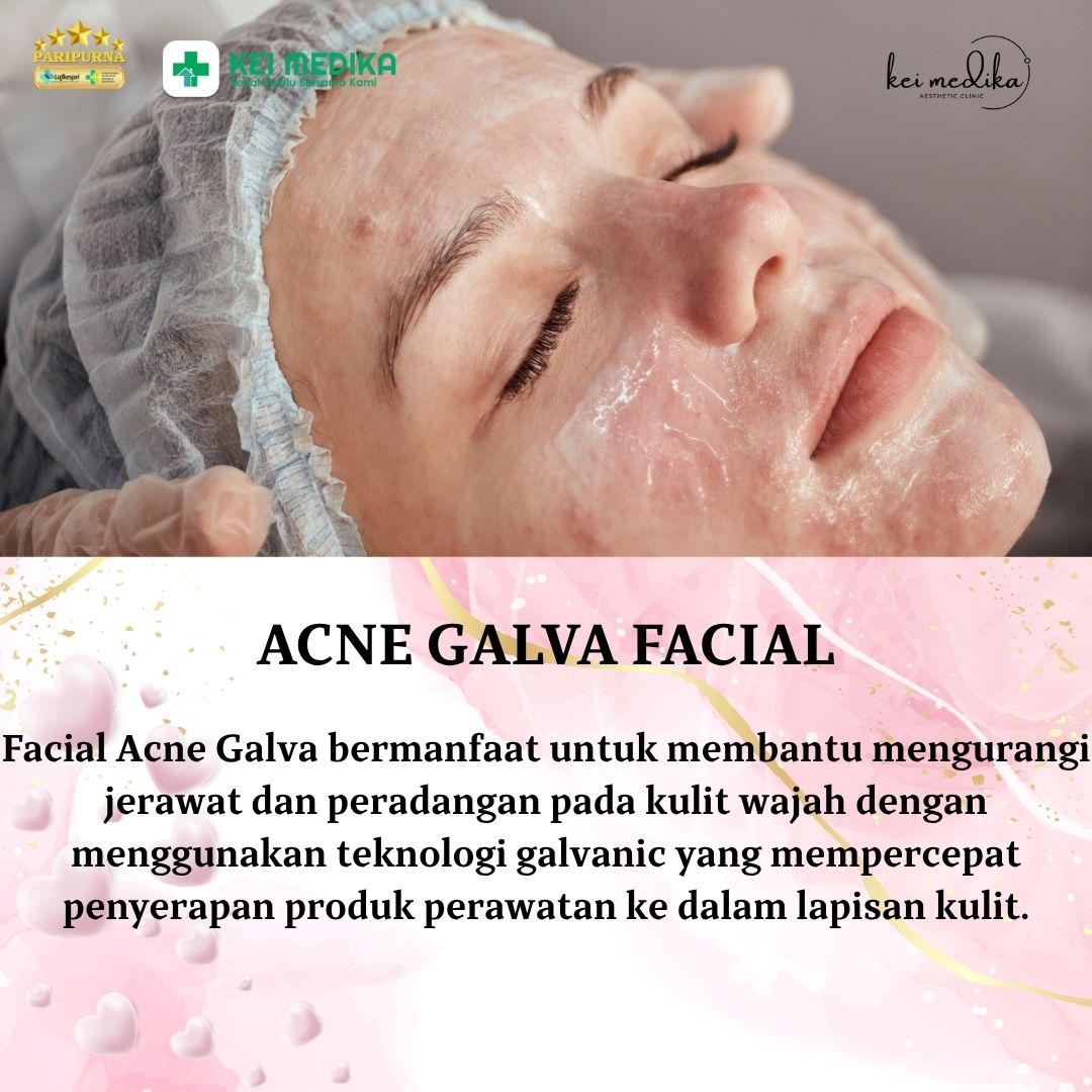 ACNE GALVA FACIAL
