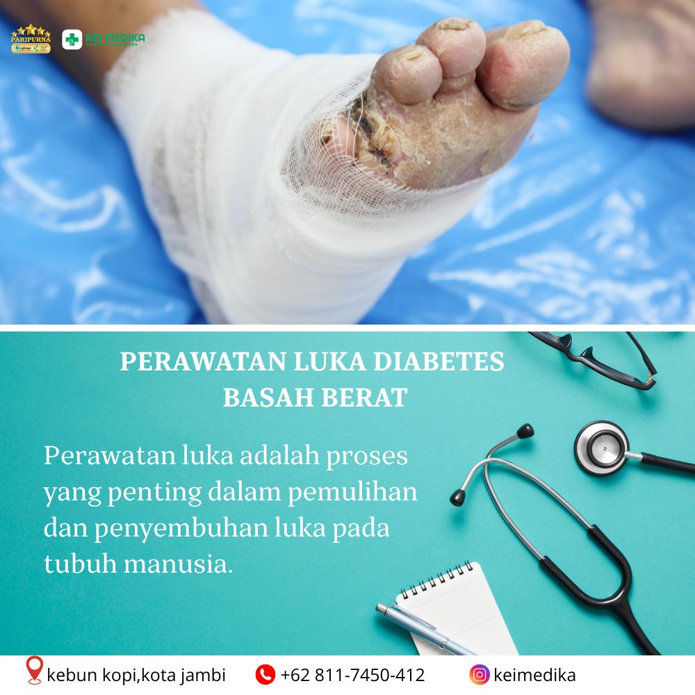  PERAWATAN LUKA DIABETES BASAH BERAT