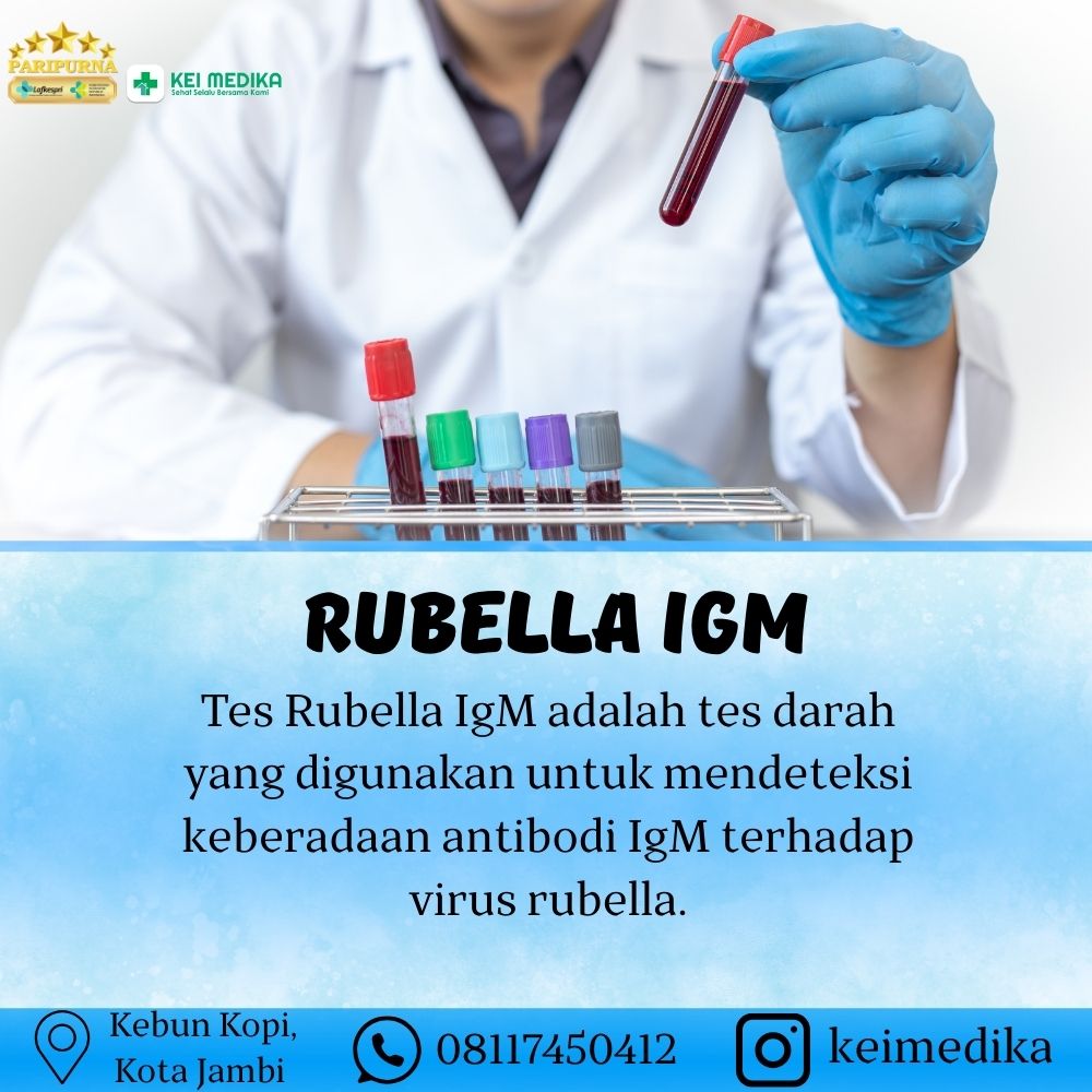 RUBELLA IGM 