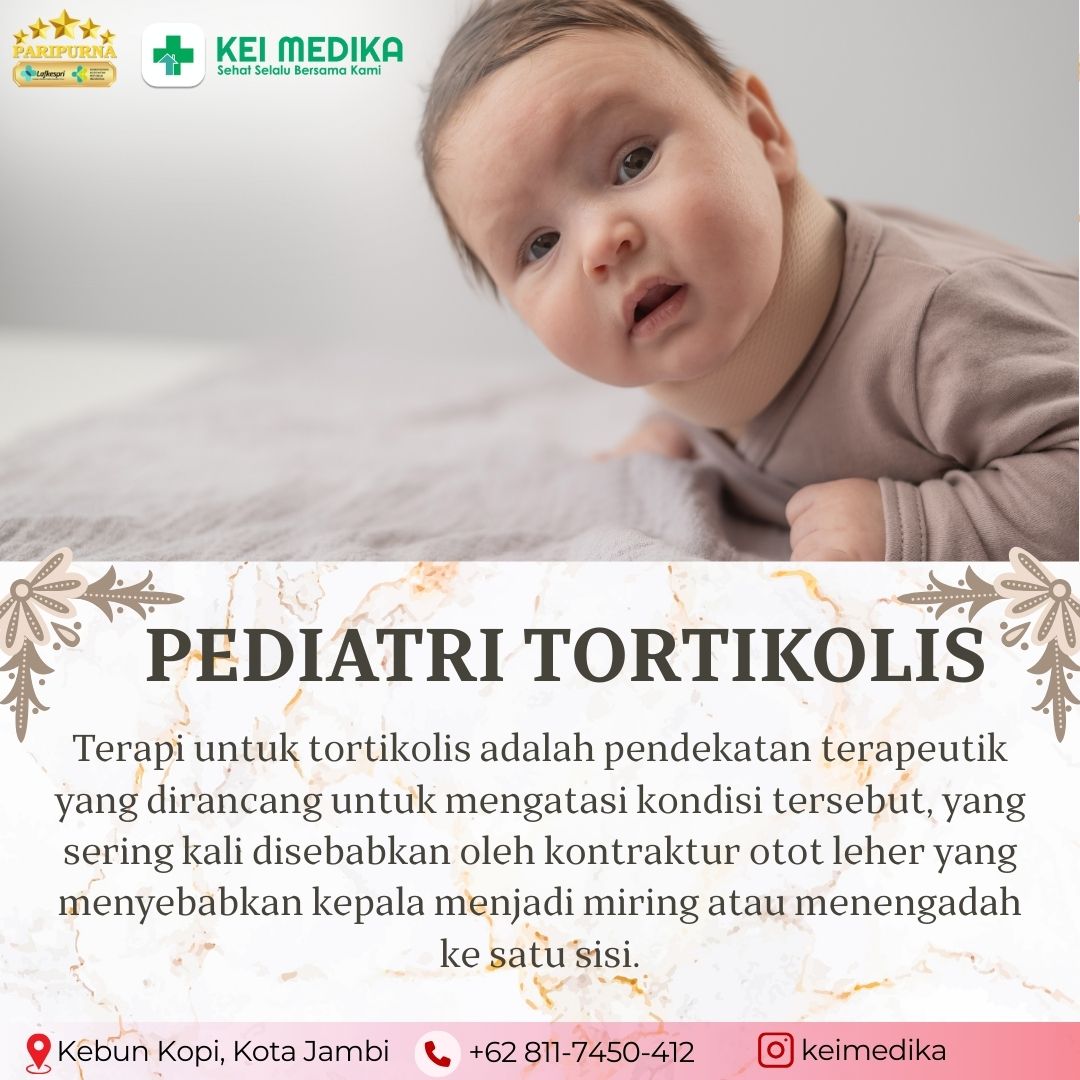 TERAPI TORTIKOLIS 5 SESI