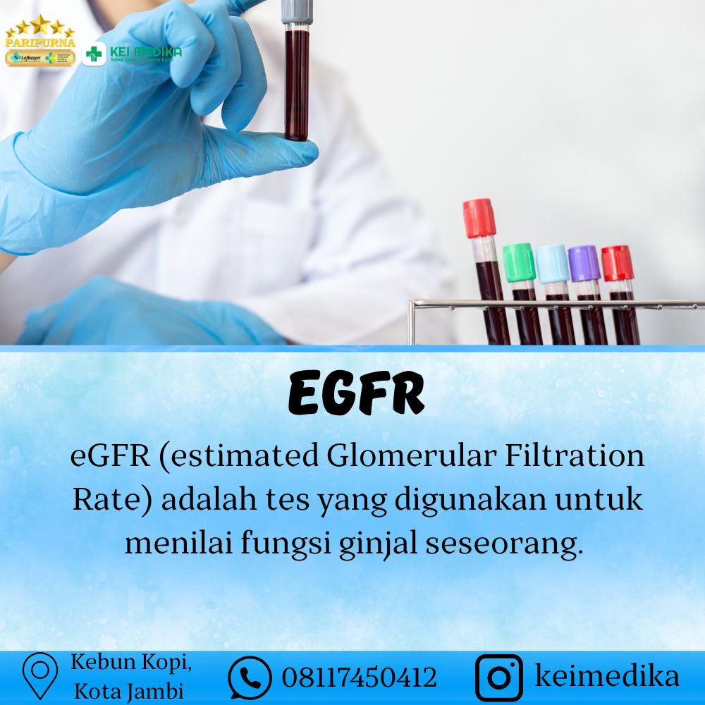 EGFR
