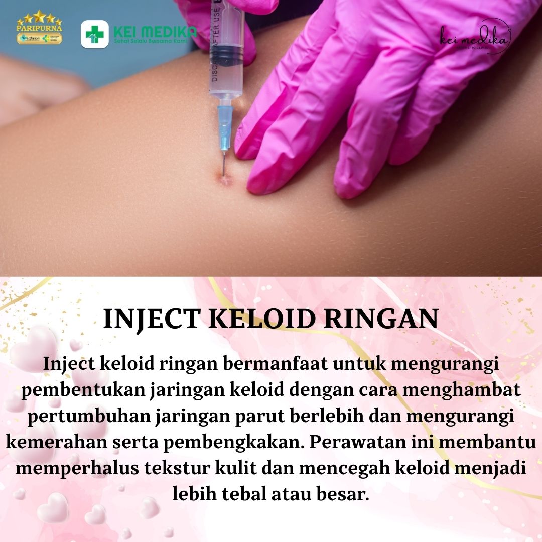 INJECT KELOID RINGAN