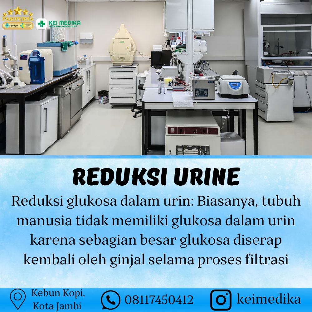 REDUKSI URINE