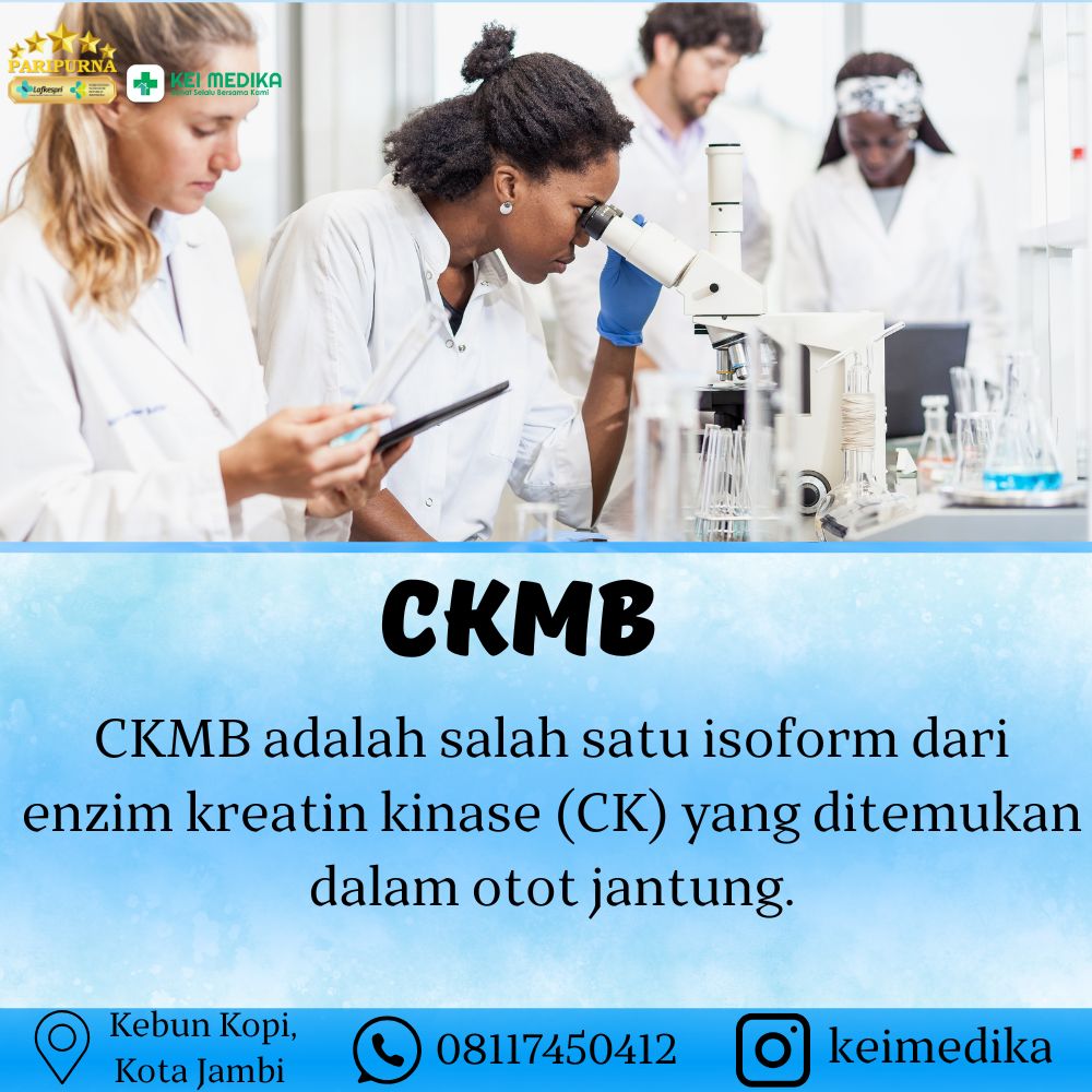 CKMB
