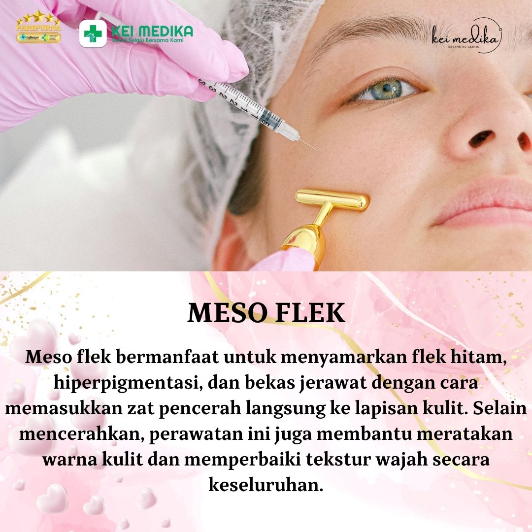 MESO FLEK