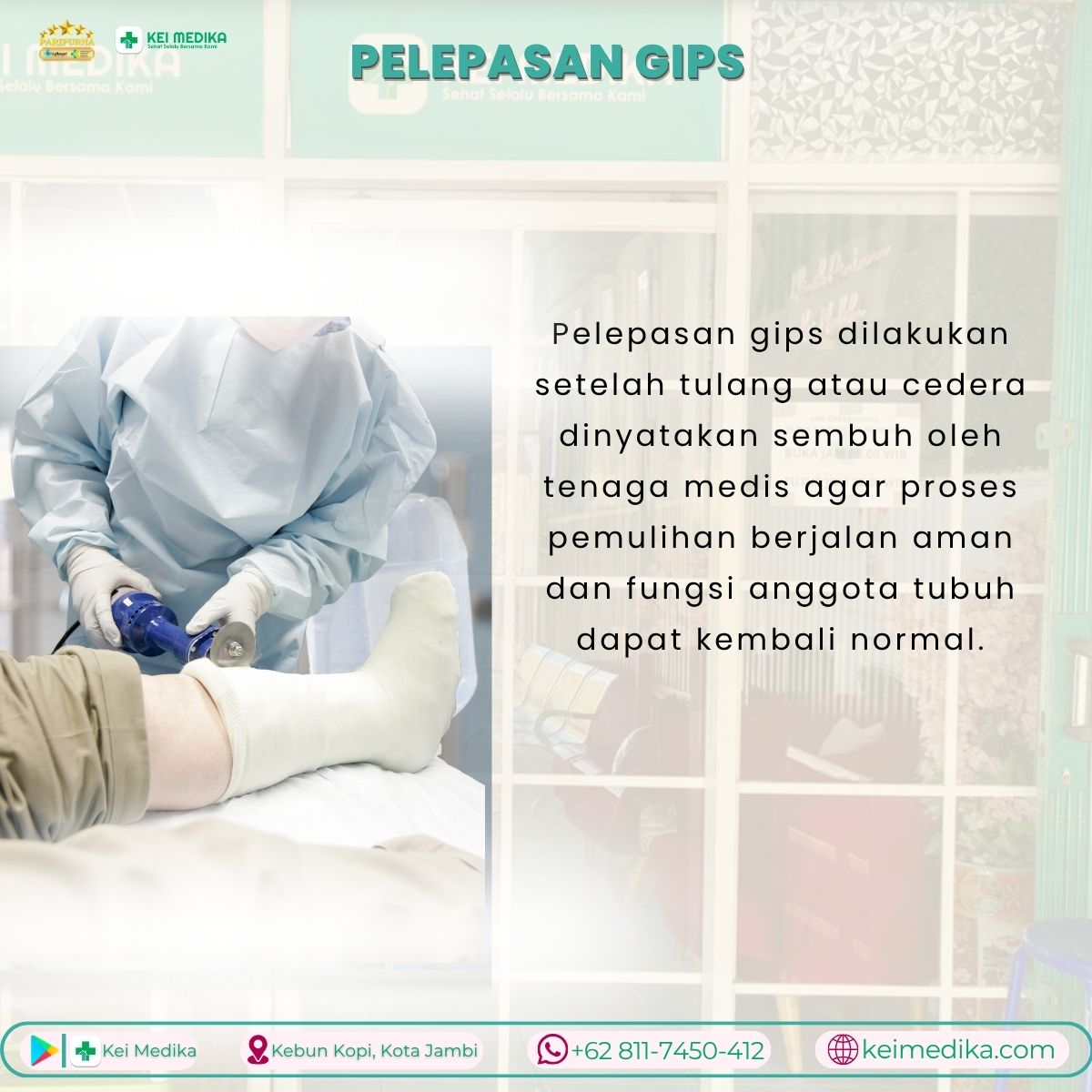 PELEPASAN GIPS