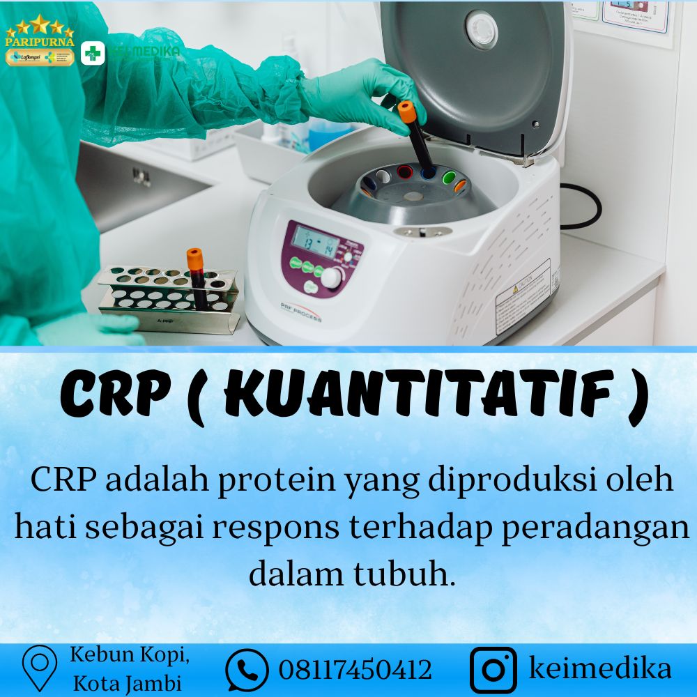 CRP ( KUANTITATIF ) 
