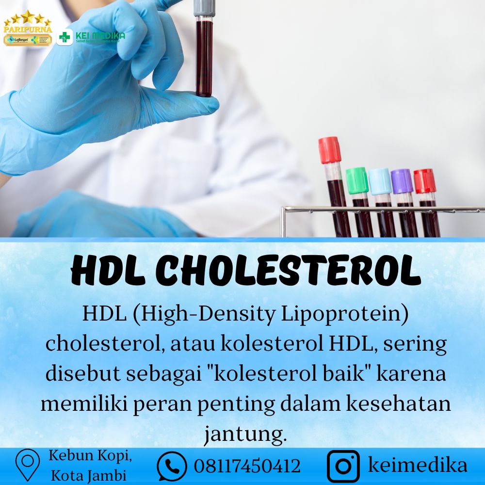 HDL CHOLESTEROL