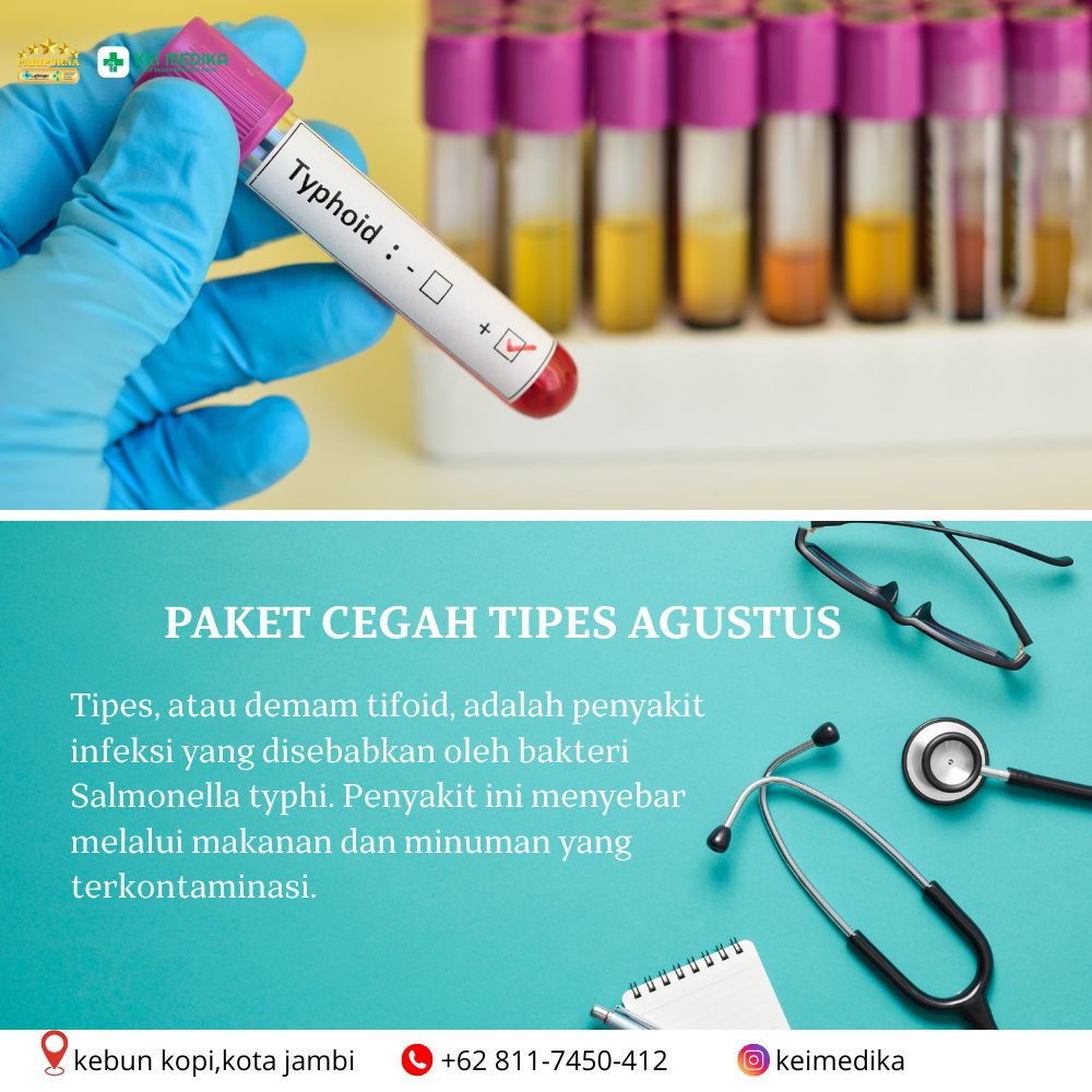 PAKET CEGAH TIPES AGUSTUS