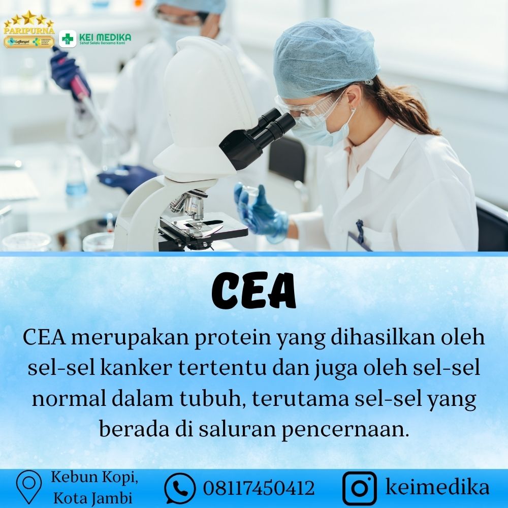 CEA