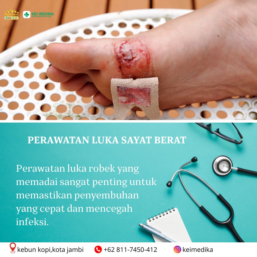 PERAWATAN LUKA SAYAT BERAT