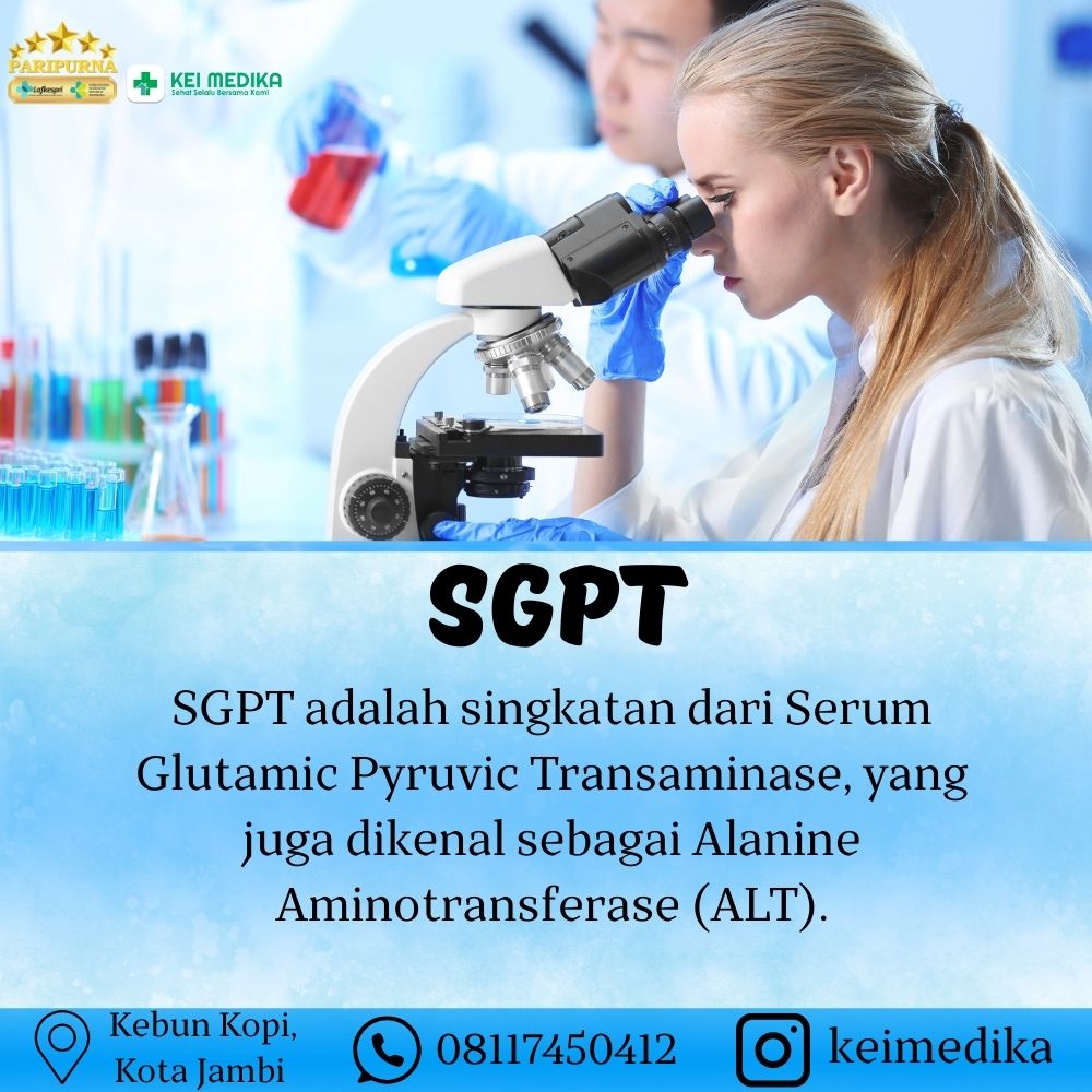 SGPT