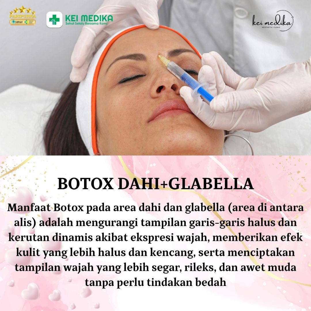 BOTOX DAHI+GLABELLA