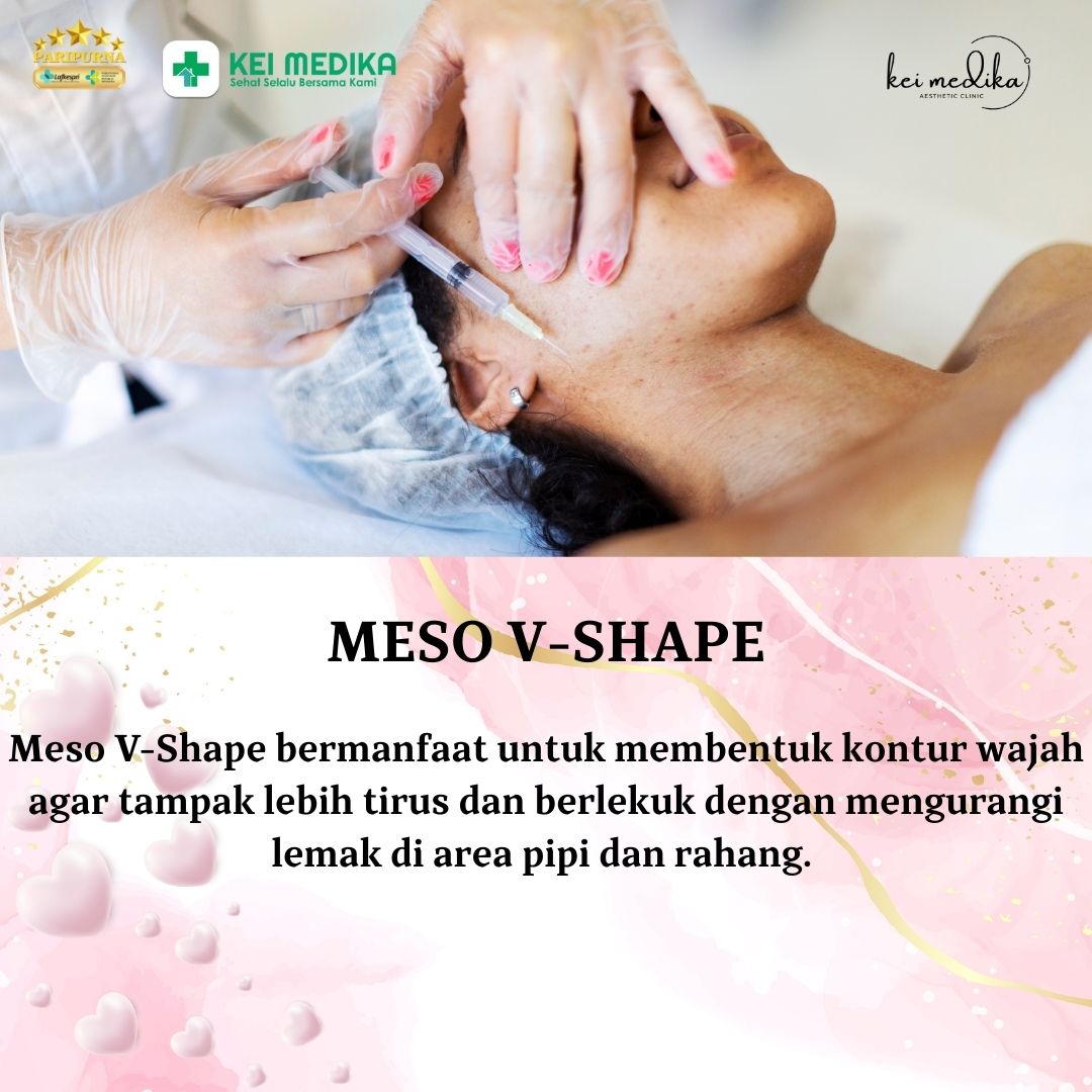 MESSO V-SHAPE