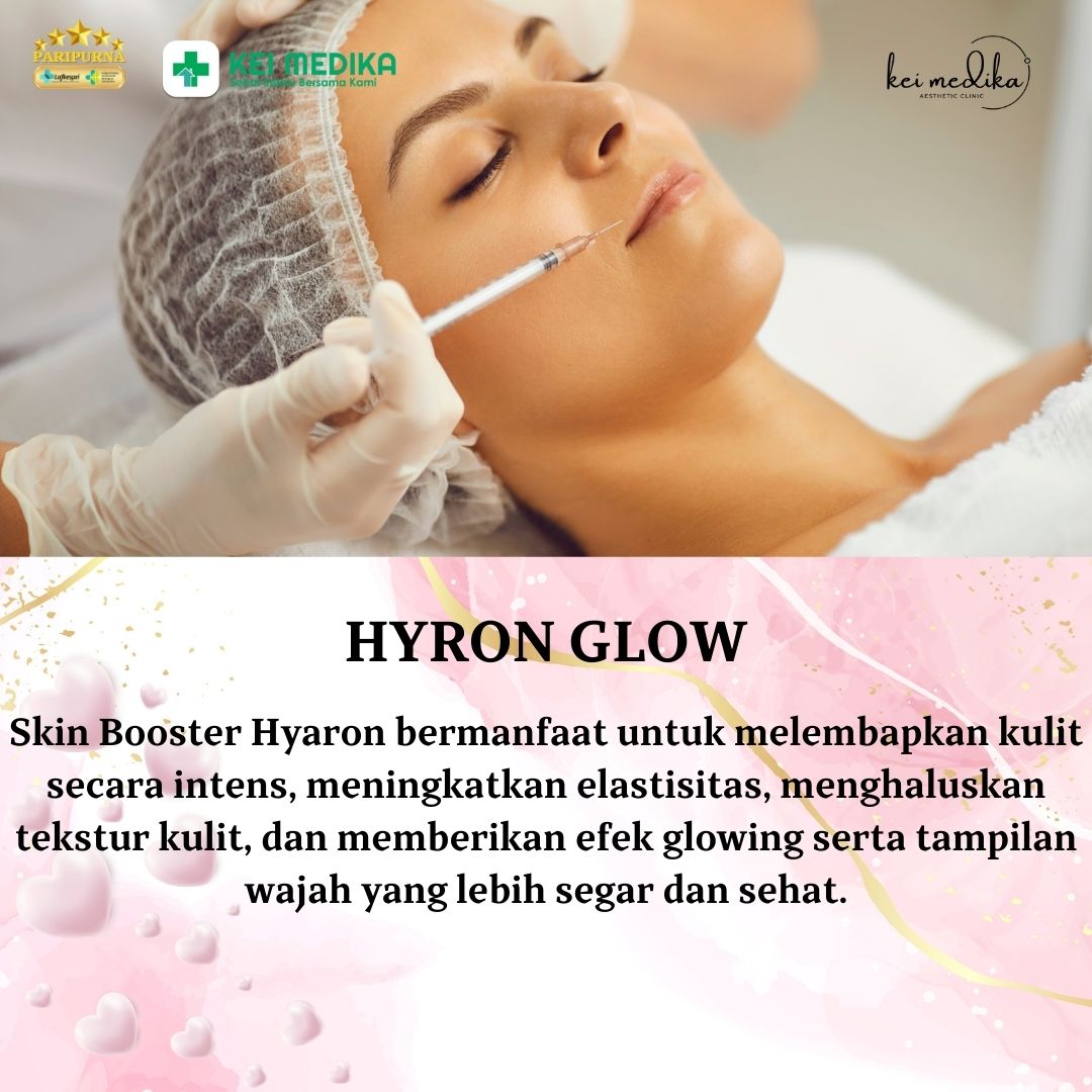 SKINBOOSTER HYRON GLOW