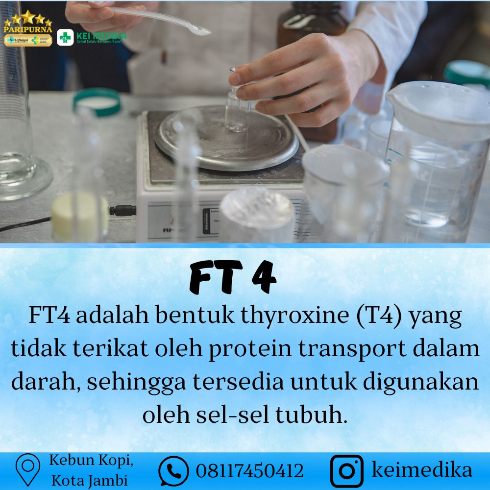 FT 4