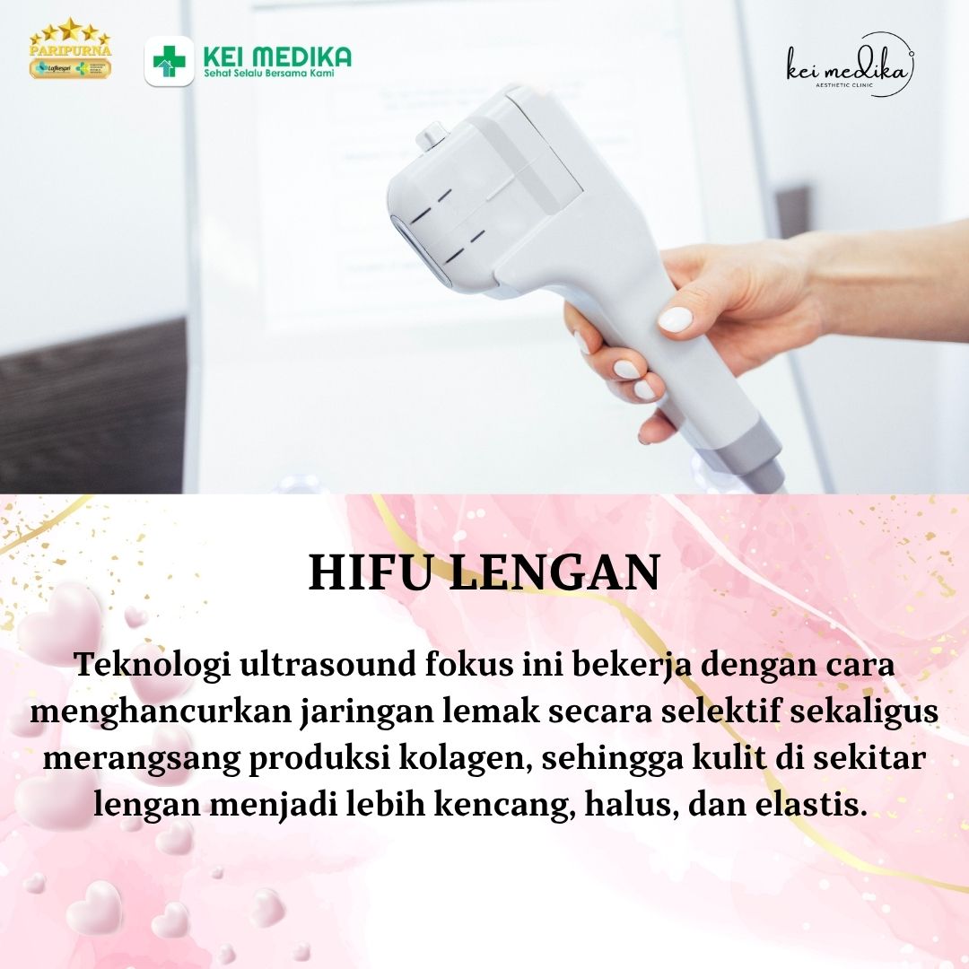 HIFU LENGAN