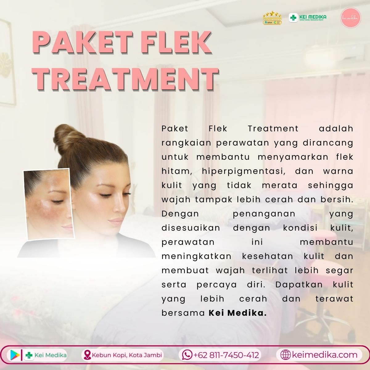 PAKET FLEK TREATMENT