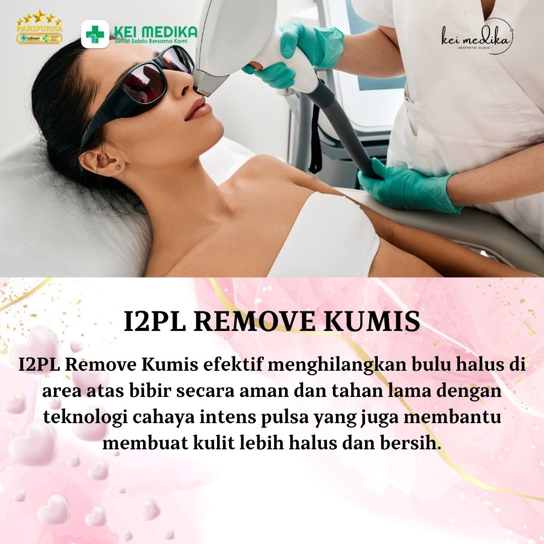 I2PL REMOVAL KUMIS