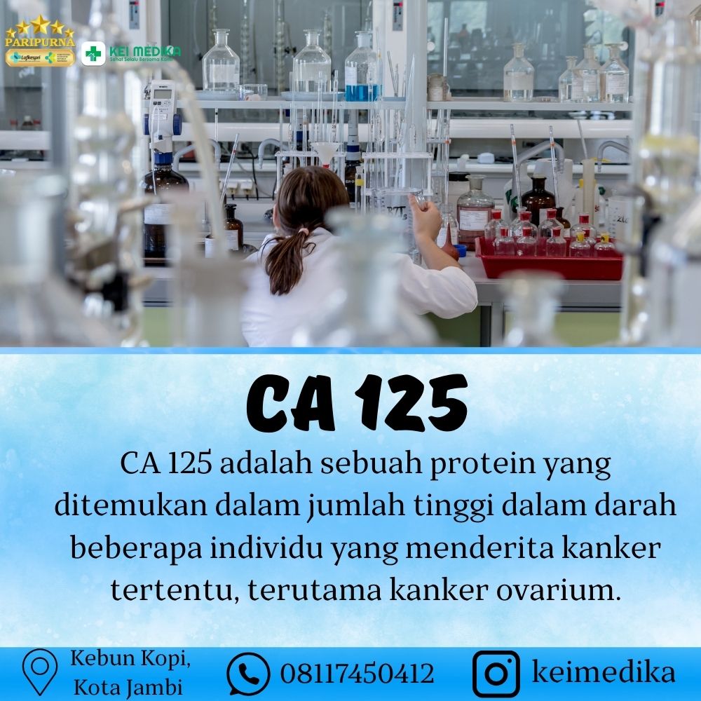 CA 125