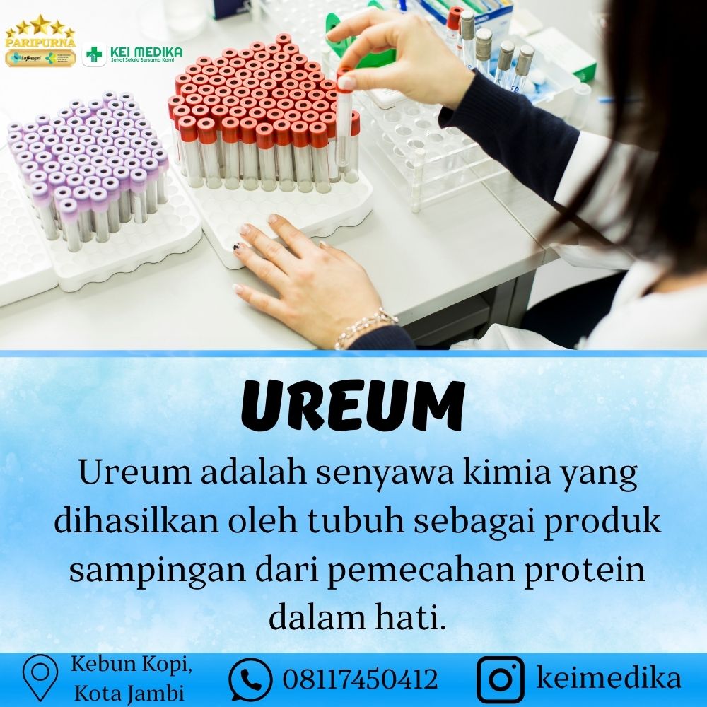 UREUM