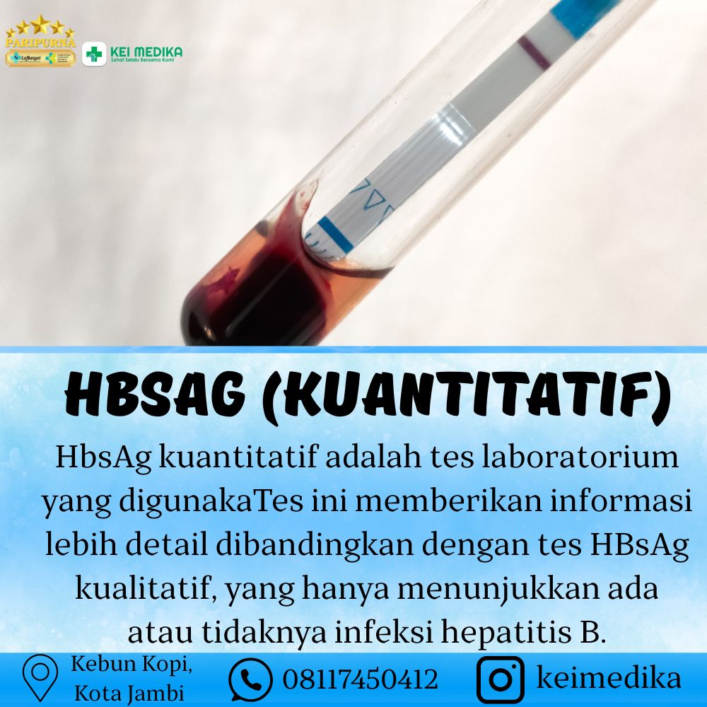 HBSAG ( KUANTITATIF)