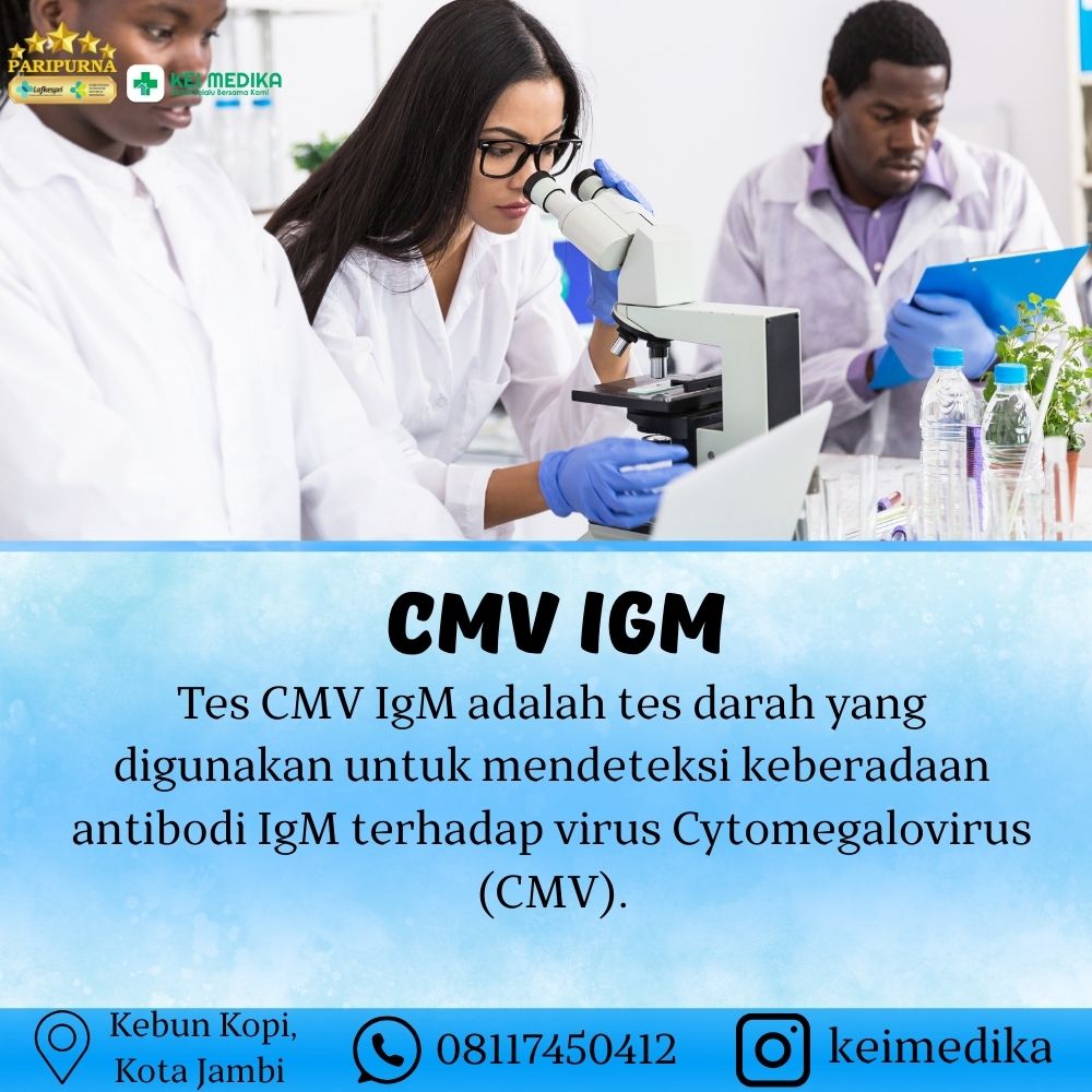CMV IGM