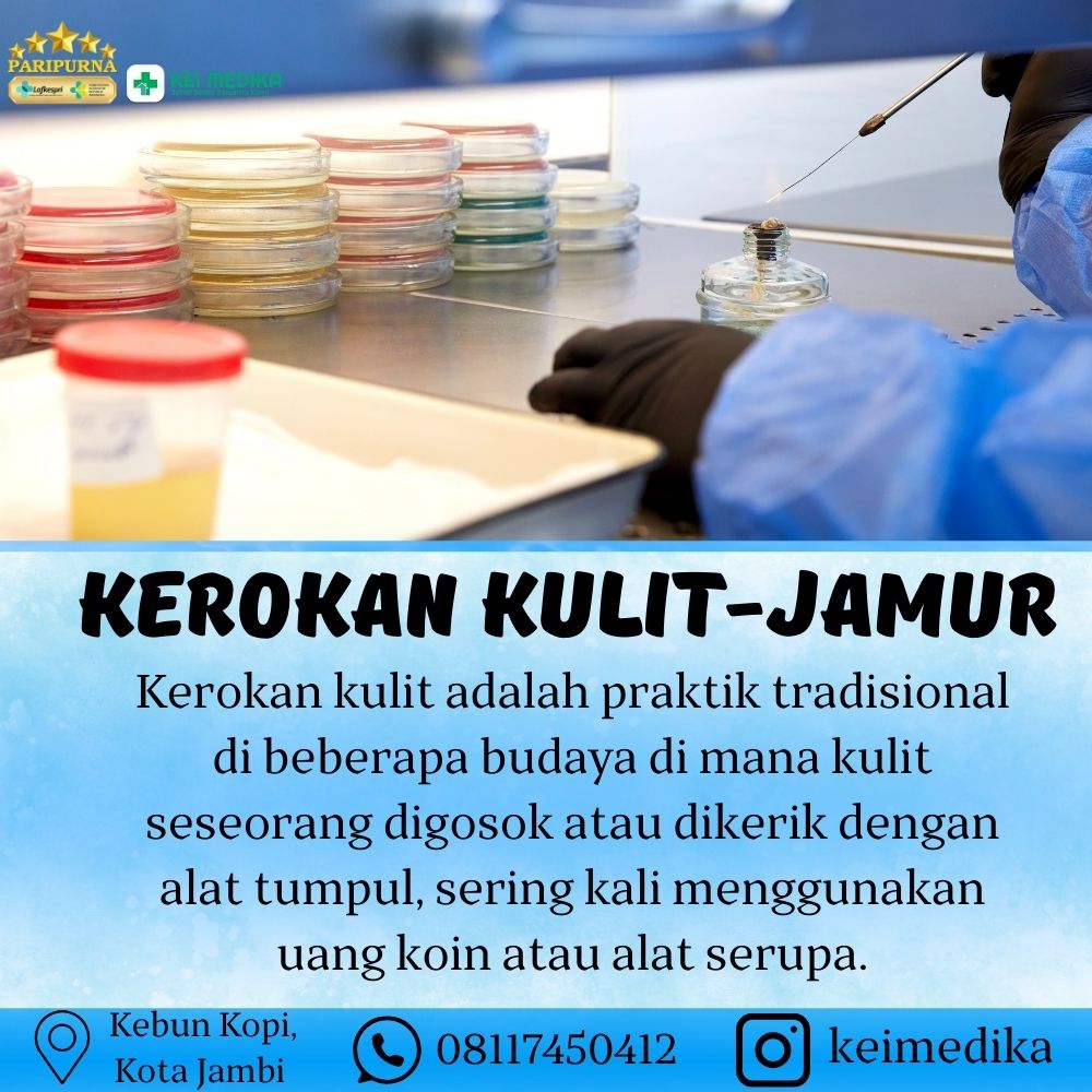 KEROKAN KULIT-JAMUR