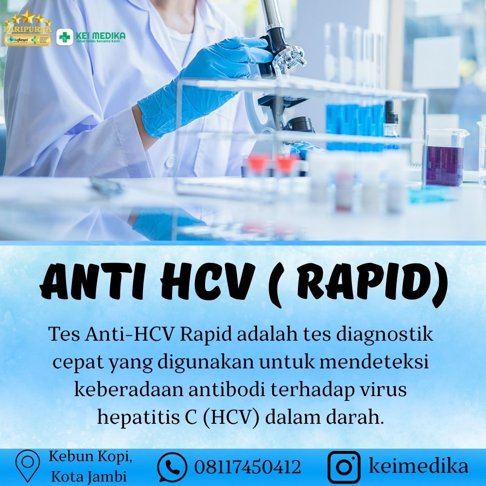 ANTI HCV ( RAPID)