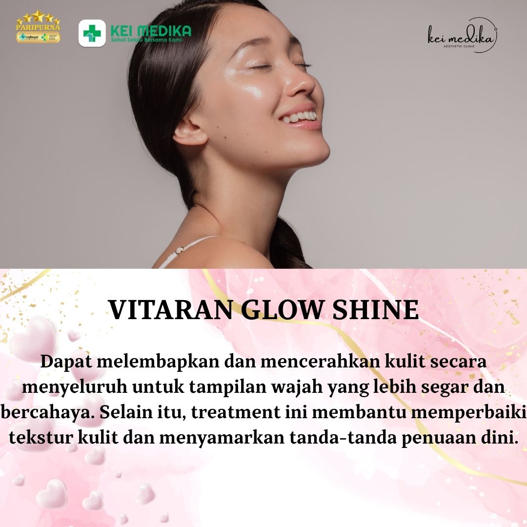 VITARAN GLOW SHINE