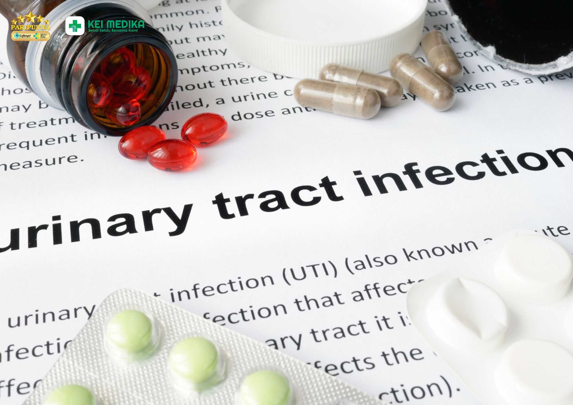 Obat Infeksi Saluran Kemih, Mengapa Harus Sesuai Penyebabnya?