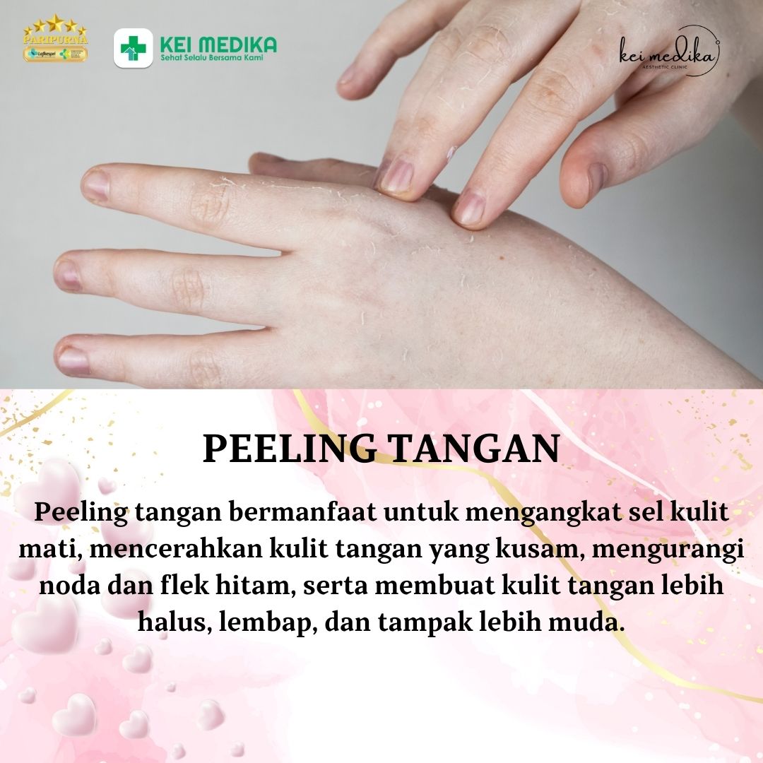 PEELING TANGAN