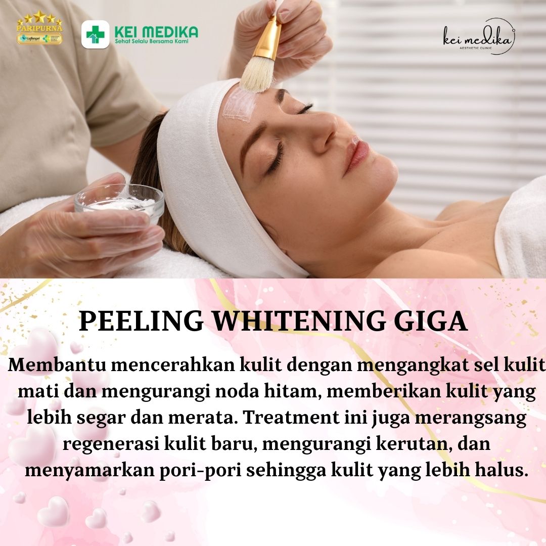 PEELING WHITENING GIGA