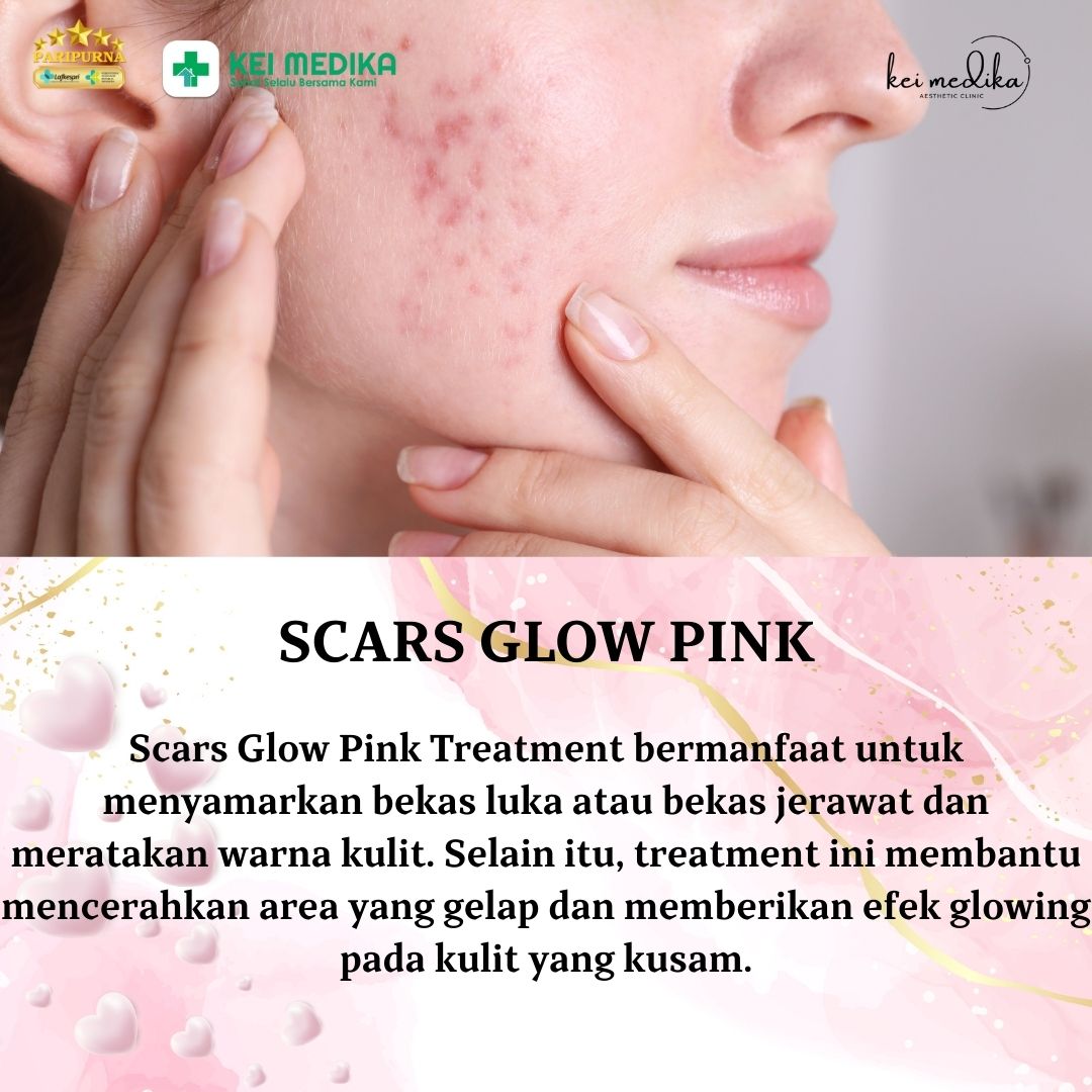 SCARS GLOW PINK