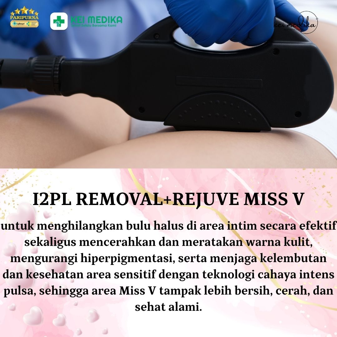 I2PL REMOVAL+REJUVE MISS V