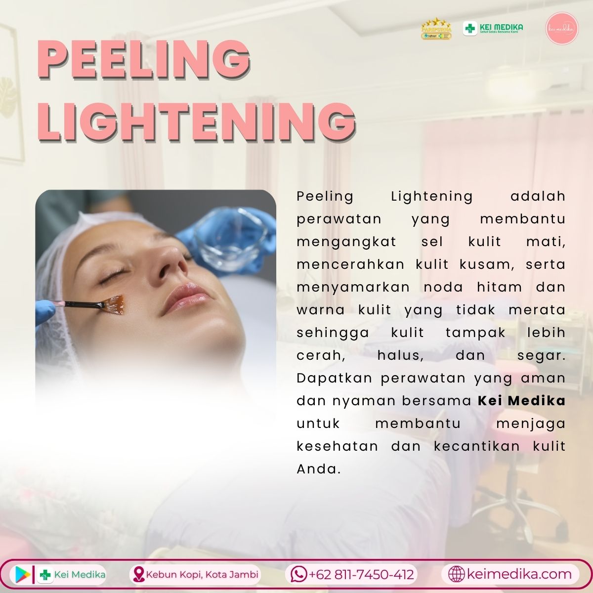PEELING LIGHTENING